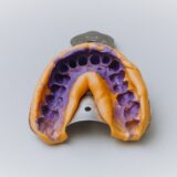 Dental Impression
