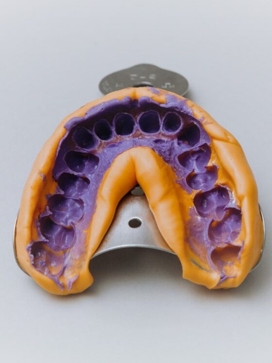 The Picky Eater Gets a Palate Expander